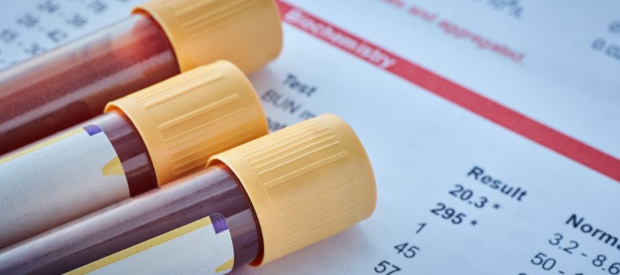 aimatologikes eksetaseis kai aima